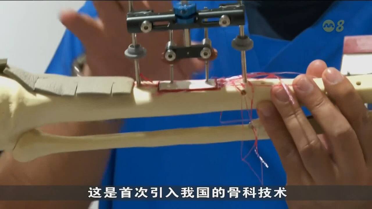 全球首例！糖尿病患者足部坏疽本地医院通过新治疗模式免截肢- 8world